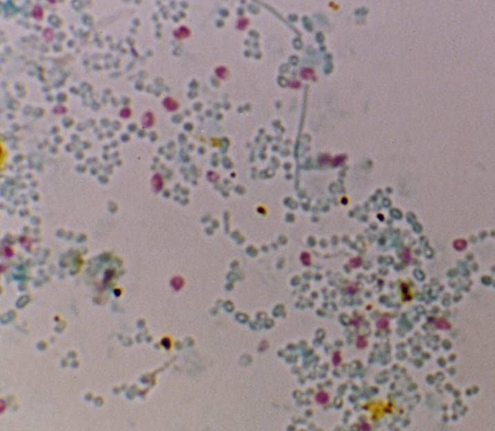 Microsporidia - Milenia Biotec