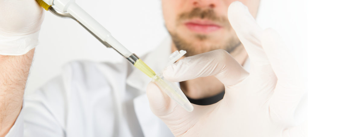 Carryover Contamination