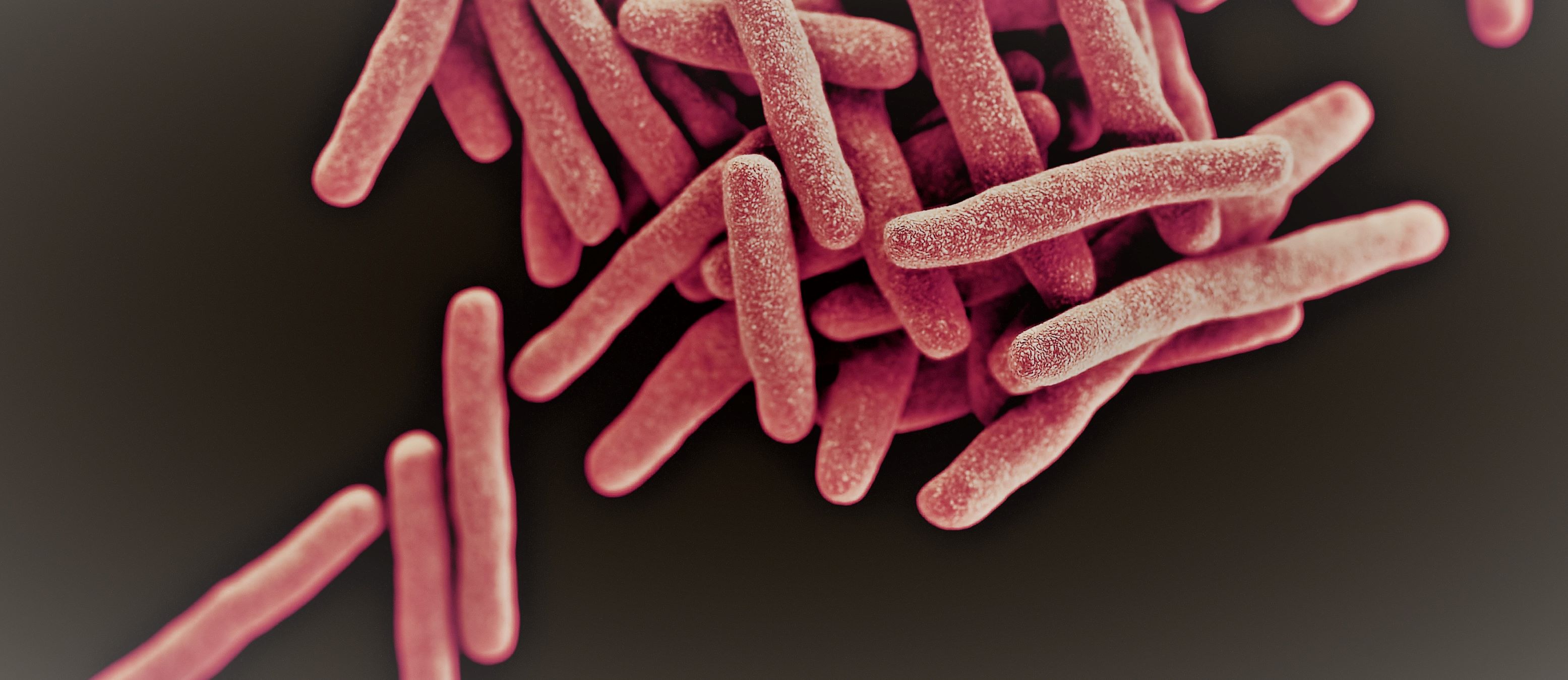健康・医学 Tuberculosis TB-cases-2023_0.png